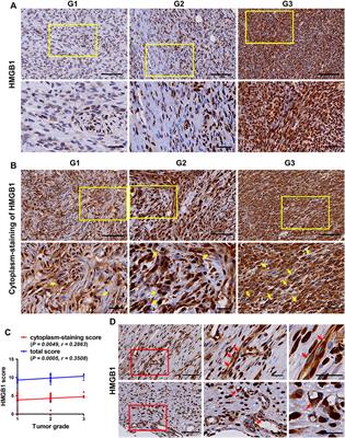 POR | HMGB1 Translocation is Associated with Tumor-Associated Myeloid ...